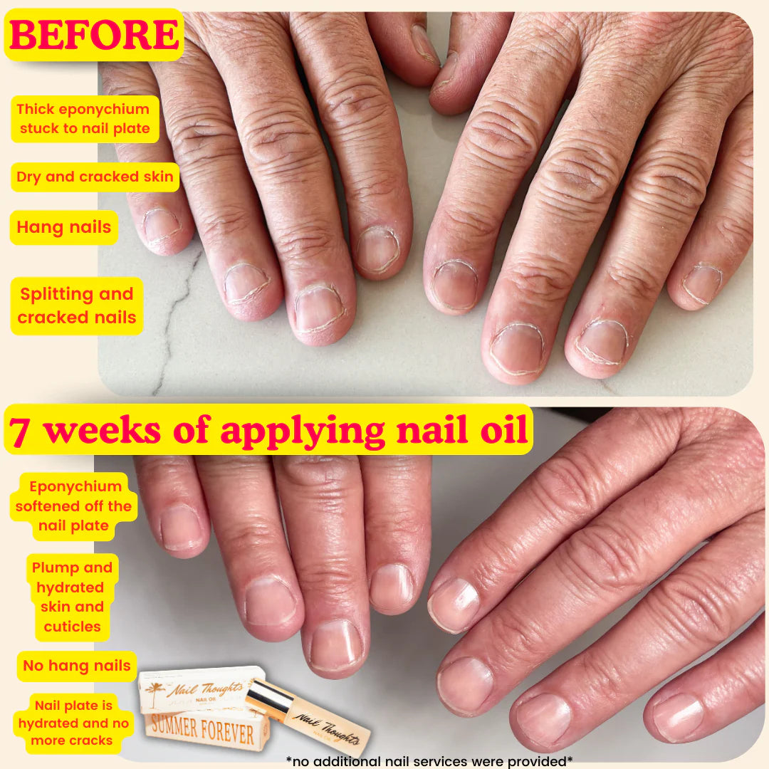 NTB- SUMMER FOREVER NAIL OIL 10ML